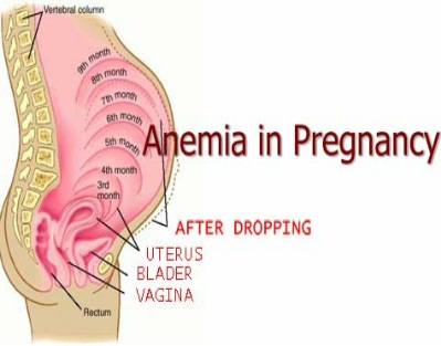 Diet In Anaemia During Pregnancy