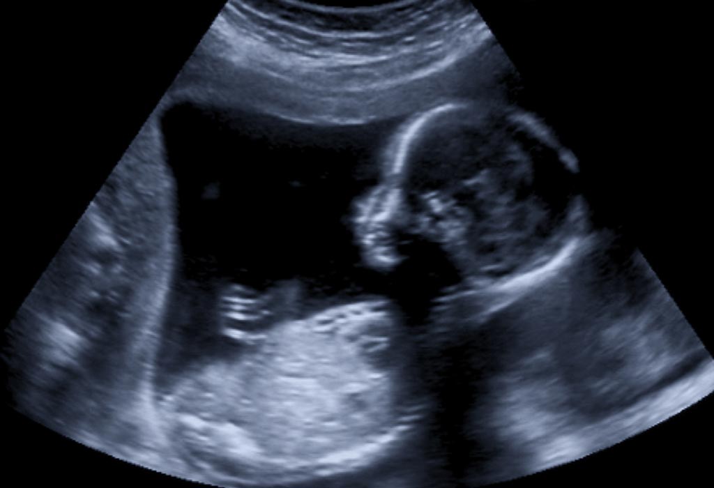 13-weeks-pregnant-symptoms-ultrasound-belly-baby-development