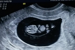 9 week ultrasound 2