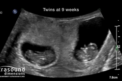 twins at 9 weeks