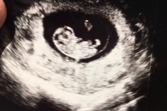 week 9 ultrasound