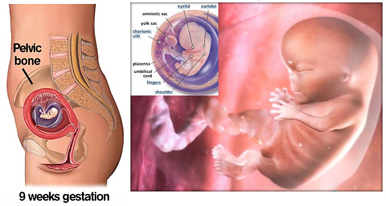 9 Week Pregnant Symptoms