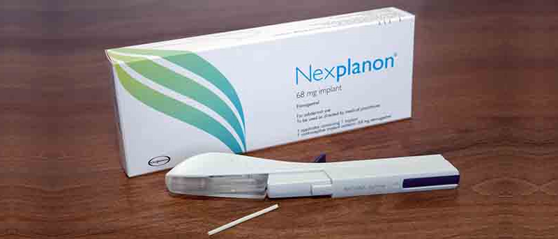 Getting Pregnant on Nexplanon