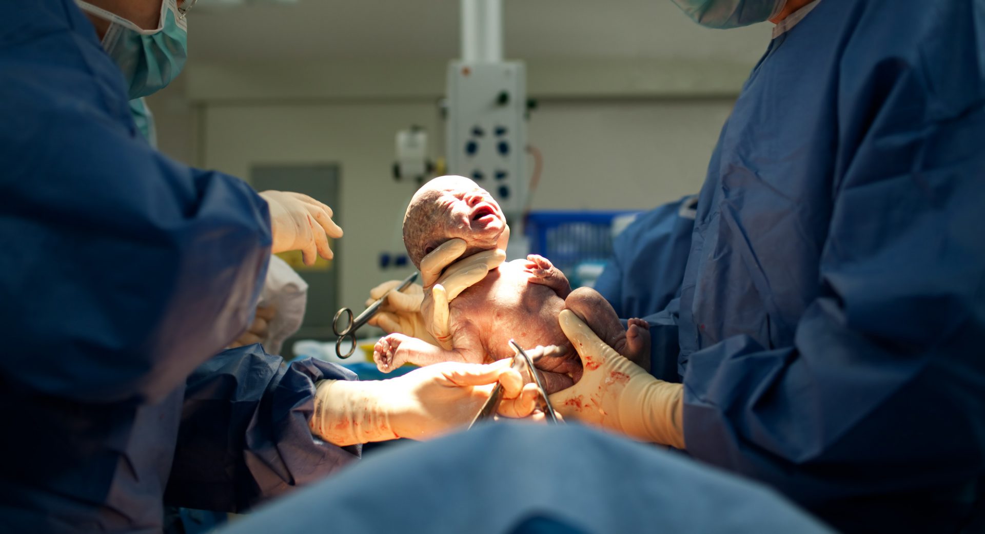 c-section recovery